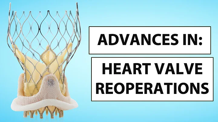 Advances in Heart Valve Reoperations Webinar with ...