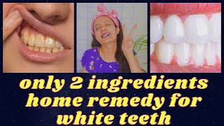 homemade remedy for white teeth / teeth whitening hacks that actually work  in HINDI