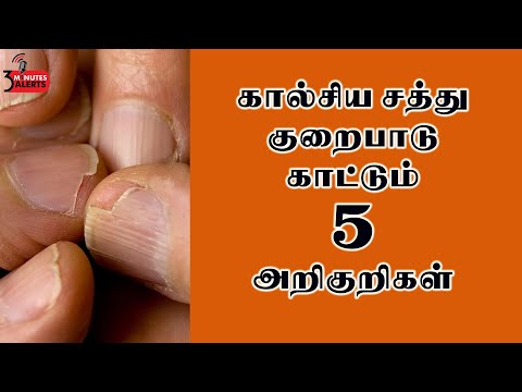 கால்சிய சத்து குறைபாடு காட்டும் 5 அறிகுறிகள் | 5 Symptoms of Calcium Deficiency in tamil | symptoms