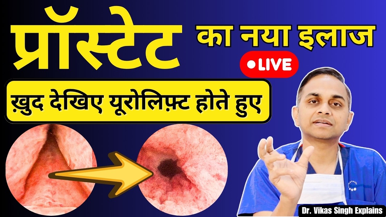 Understanding UroLift: The Modern "Stapler" Treatment for Enlarged Prostate (BPH)