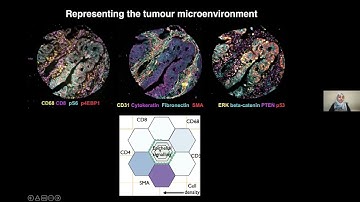 Heba Sailem: Shapography, a tool for glyph-based data visualization.