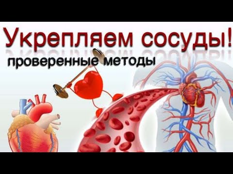 Видео: Как укрепить стенки артерий?