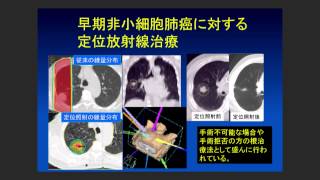 ISOUKAIx画像診断 「がん治療における『低侵襲』の意味と応用 大西洋先生