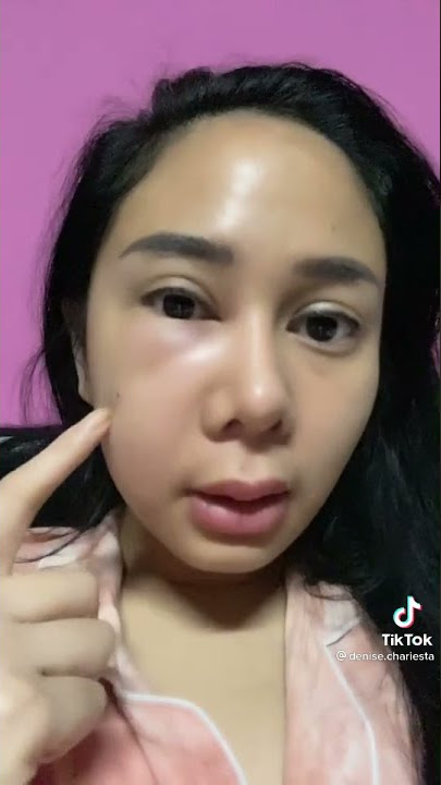 Denise Chariesta babak belur dibikin Dewi  persik#shorts