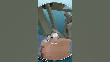 Robotic Partial Nephrectomy Surgery (3D animation) #music #motivation #epic #like