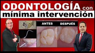 ODONTOLOGÍA DE MÍNIMA INTERVENCIÓN / MÍNIMAMENTE INVASIVA O MÍNIMA  INVASIÓN screenshot 3