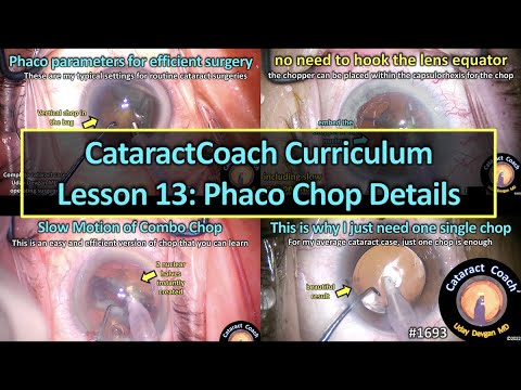 CataractCoach™ 1693: curriculum lesson 13: phaco chop details