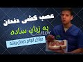 درمان ریشه یا عصب کشی به زبان ساده  با دکتر افشین کاوسی