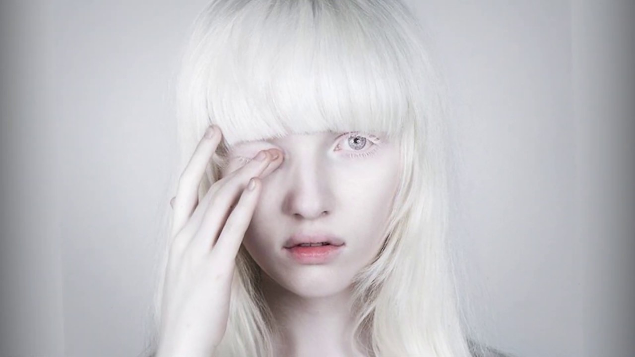 Включи белыми глазами. Глазокожный альбинизм Тип 3. Девушка с белыми ресницами. Белые глаза у человека. Девушка альбинос.