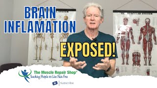 Your Brain on Ultra-Processed Foods | The Link Between Highly Processed Foods and Brain Health