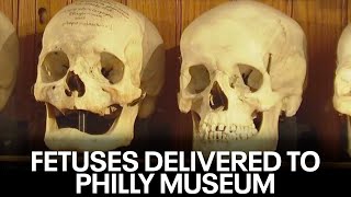 Package with 2 preserved fetuses received by Mutter Museum in Philadelphia