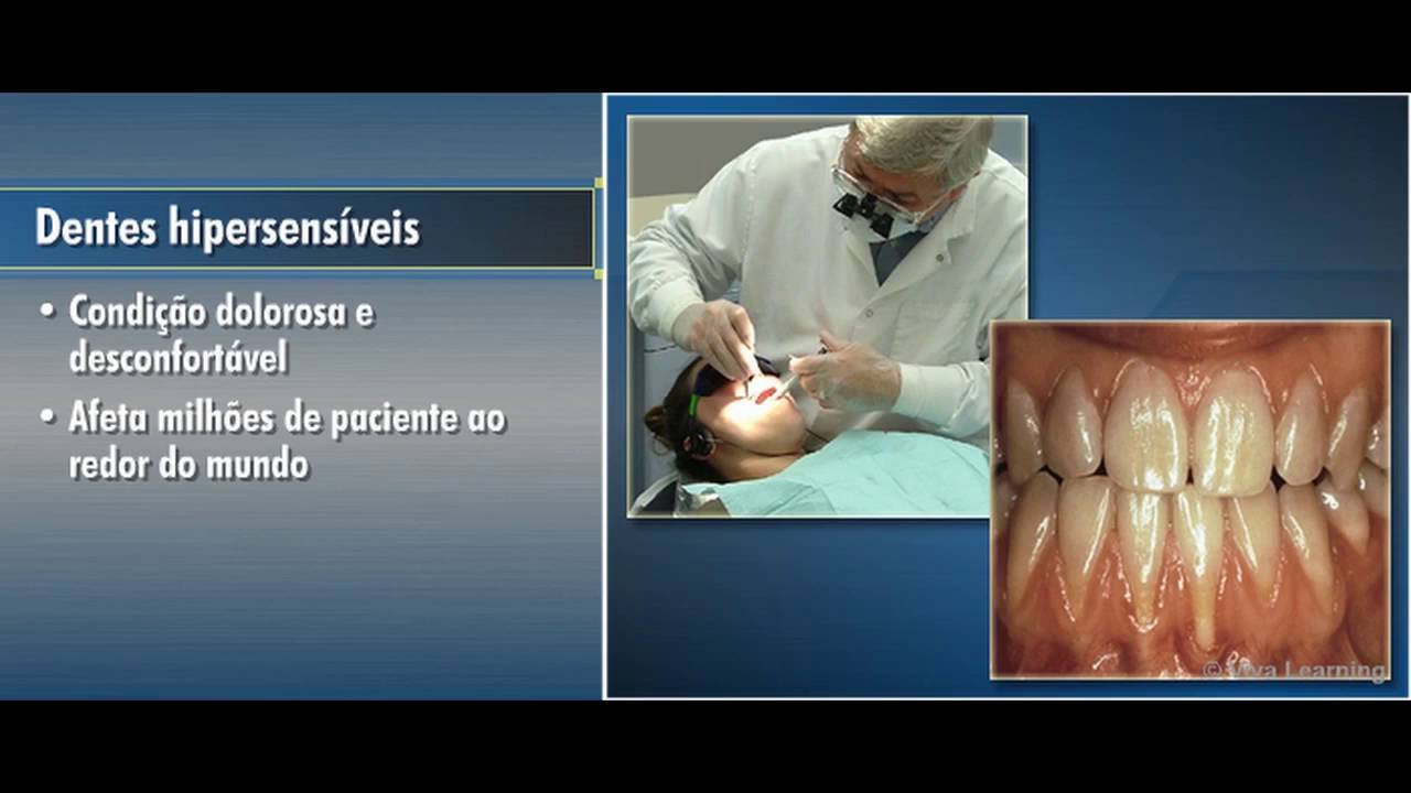 VOCO Profluorid Varnish VOCO do Brasil YouTube