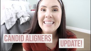 CANDID ALIGNERS UPDATE | trying my aligners on for the first time!