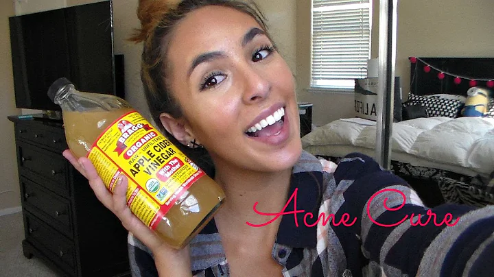 Acne Cure | Francesca Ward