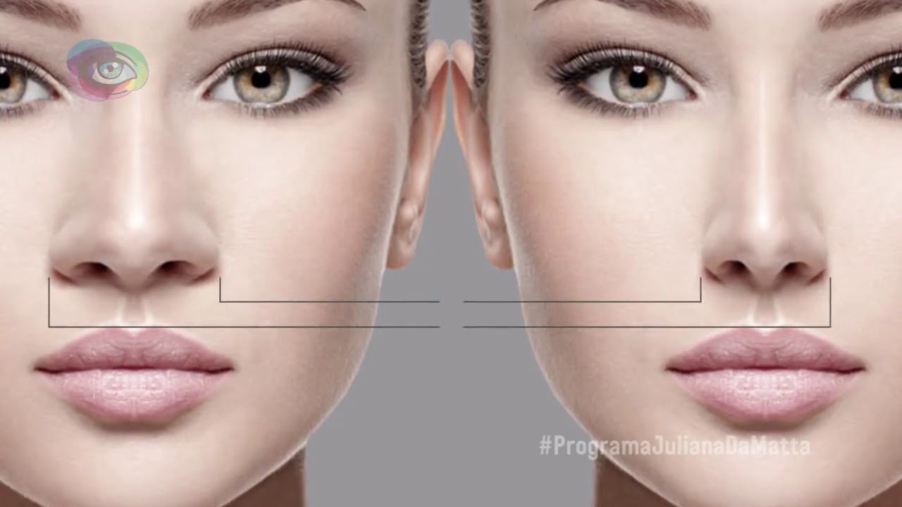 Rinoplastia conhecida também como Cirurgia de Nariz - YouTube