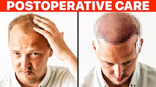 Hair Transplant: PostOp Recovery