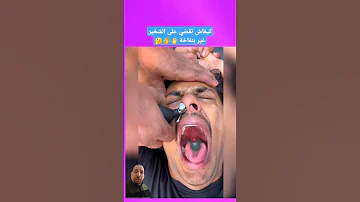 كيفاش تقضي على الشخير غير بنفاخة 