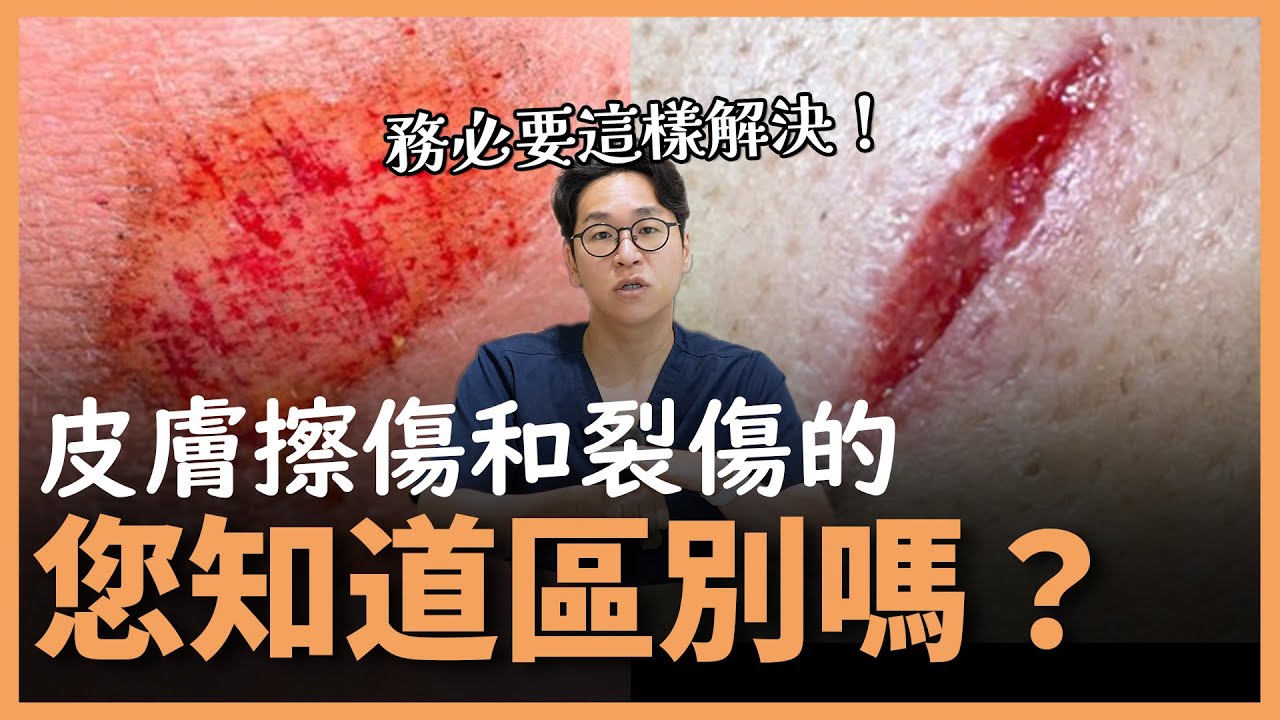 皮膚擦傷與裂傷如何治療?專家建議必看! | 林克整形醫院 | 成河旻代表院長 - YouTube