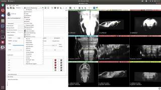 Landmark registration with 3DSlicer