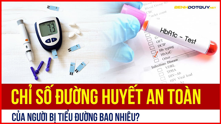 Bao nhiêu giấy than ngoại xanh horse trong một gram năm 2024