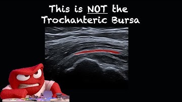 Ultrasound of the Lateral Hip and Trochanteric Bursa