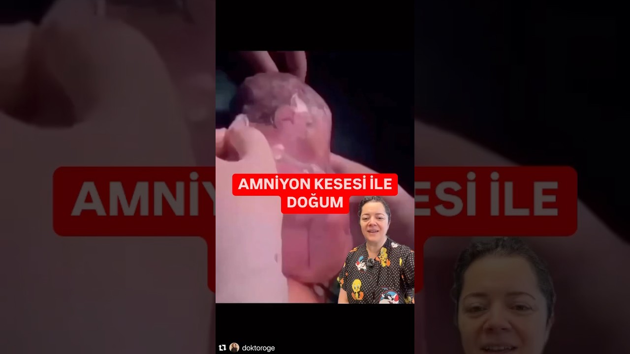 ⚠️ Amniyon kesesi açılmadan doğum ve kulağa su kaçar mı endişesine bir video bıraktım.