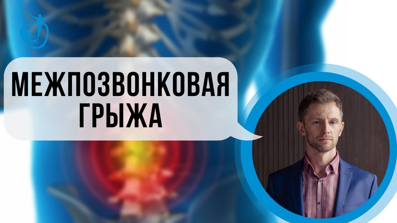 МЕЖПОЗВОНКОВАЯ ГРЫЖА (Протрузия) - Лечить или Удалять? Владимир Животов