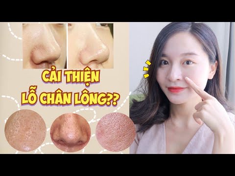 TẠI SAO LỖ CHÂN LÔNG CỦA BẠN TO ??| SKINCARE | BOONTRANG