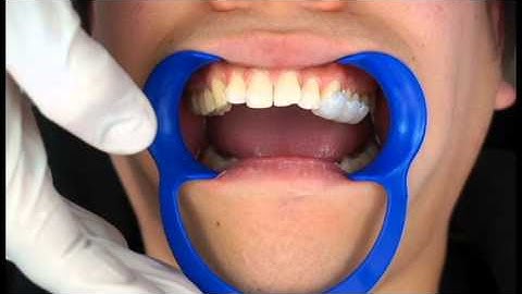 INDIVIDUA meets 3M APC PLUS