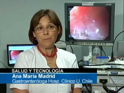 Pastilla Endoscpica en (CNN CHILE)