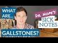 What are gallbladder stones?