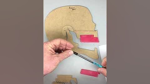 Centric Relation, RCP, ICP and OVD for Complete Dentures