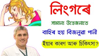 সংগীৰ লগত ফোনত কথা পাতিলেই পানীৰ দৰে বিজলুৱা পদাৰ্থ বাহিৰ হোৱাৰ কাৰণ আৰু চিকিৎসা