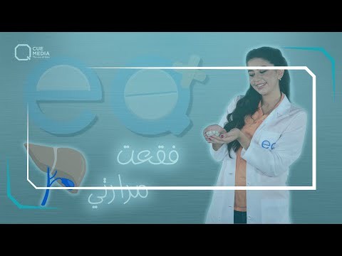 حصيات المرارة ودور العصارة الصفراوية