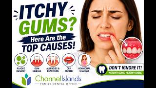 Itchy Gums? Top Causes How To Stop The Itch Channel Islands Family Dental Office