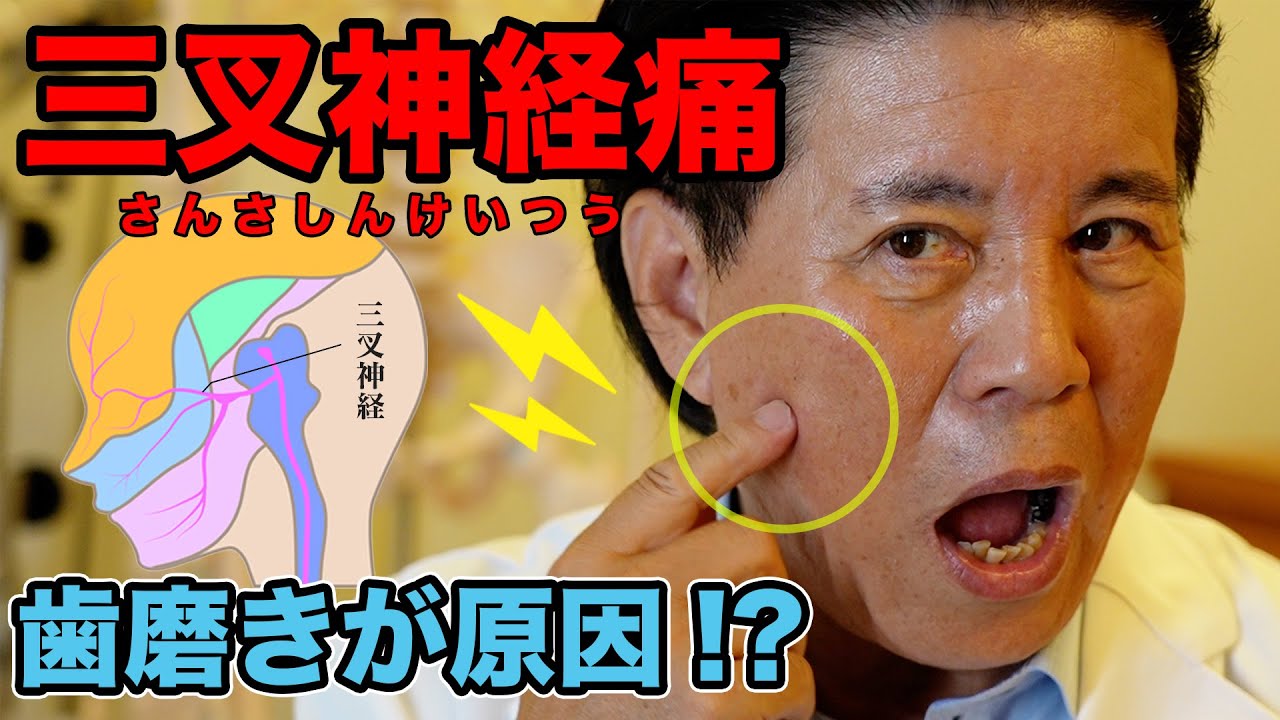 三叉神経痛緩和ツボ: 三叉神経 経穴 : 三叉神経痛の症状を改善する原因への有効な対策と治療方法 | WDUM