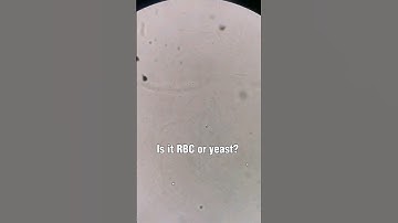 Microscopic examination of urine RBC vs Yeast #laboratory #medtechstudent #cls #mls #urinesediment