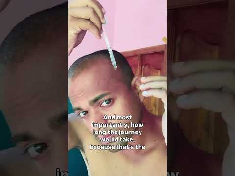 Don’t ignore your hairfall🙃