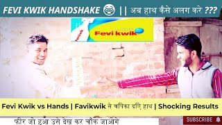 Fevi Kwik Vs Hands फवकवक स चपक दए हथ Shocking Results How To Remove Feviquick From Hand