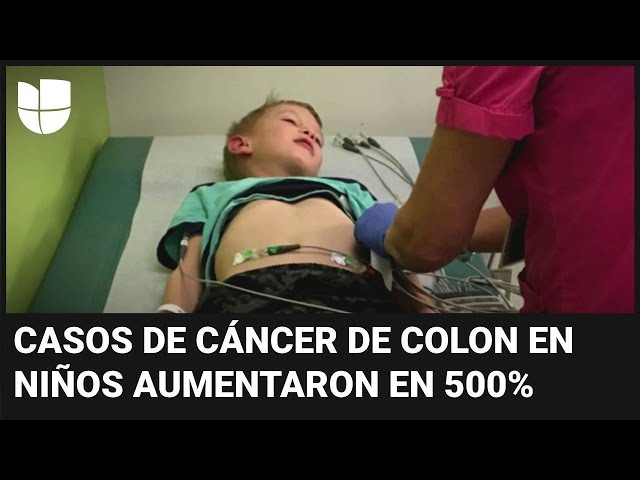 Preocupación por aumento de casos de cáncer de colon en niños y adolescentes en EEUU, según estudio