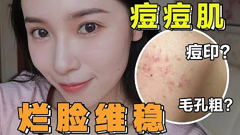 一站式解决痘肌问题，7年痘印如何去？毛孔粗，痘痘反复长怎么办？【文不叮Winnie】 - 天天要闻