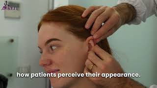 Otoplasty: Your Complete Guide to Ear Pinning Surgery