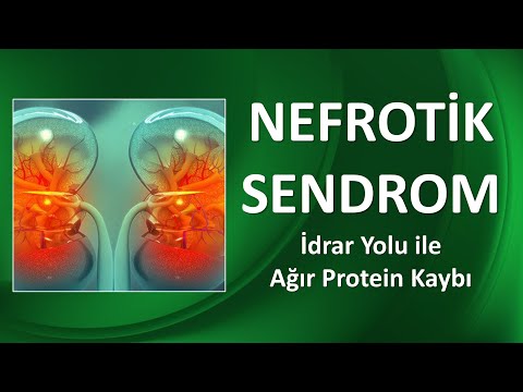 NEFROTİK SENDROM NEDİR? İdrar Yolu ile Ağır Protein Kaybı