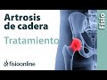 Consejos para la artrosis. Tratamiento y remedios para mejorar el dolor