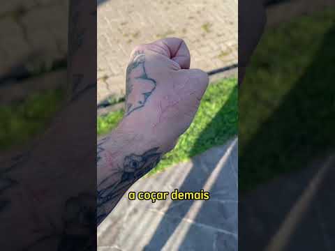 Vídeo: As tatuagens desbotadas são mais fáceis de remover?