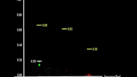 Off-line EEG Sonification (ball amplitude is an indicator for Alzheimer