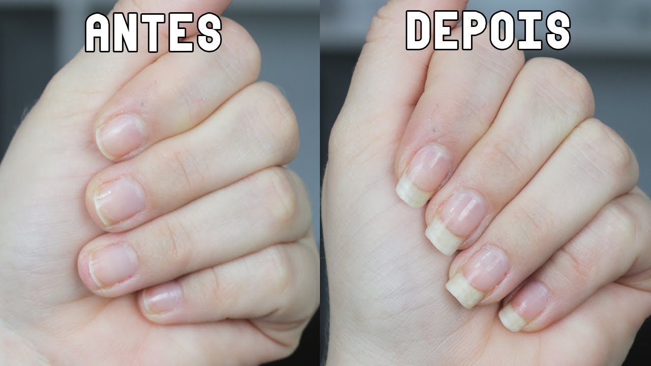 UM INGREDIENTE FEZ MINHA UNHA CRESCER EM 5 DIAS - FORTE E SAUDAVEL ...
