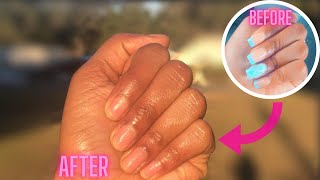 DIY | How to Properly Remove Acrylic Nails at Home