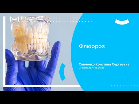 🦷 Флюороз