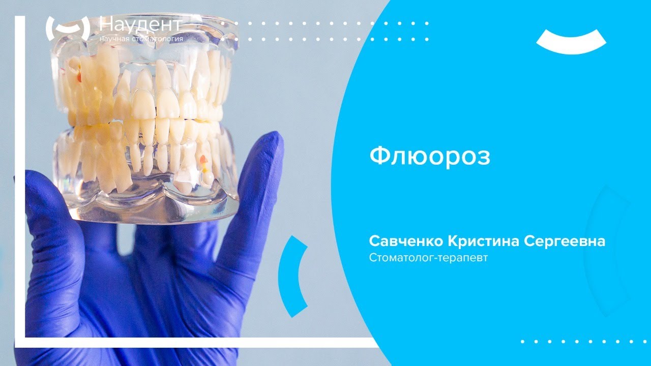🦷 Флюороз